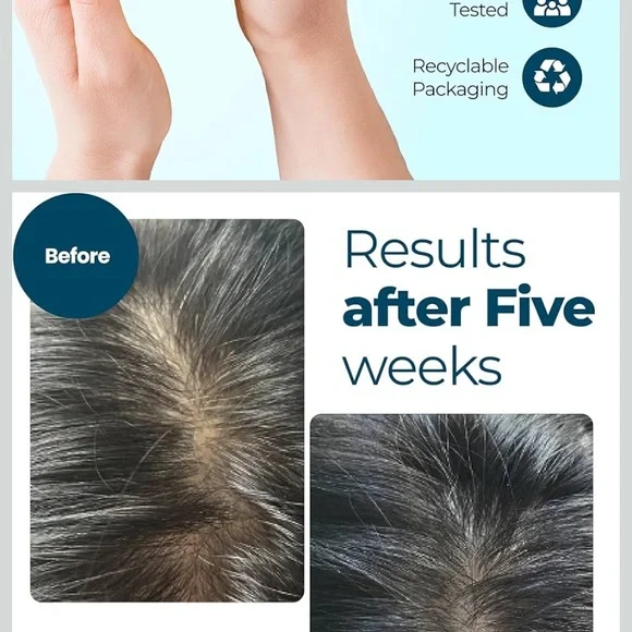 Hair Growth Oil - Black Packaging - Picture 4 of 16